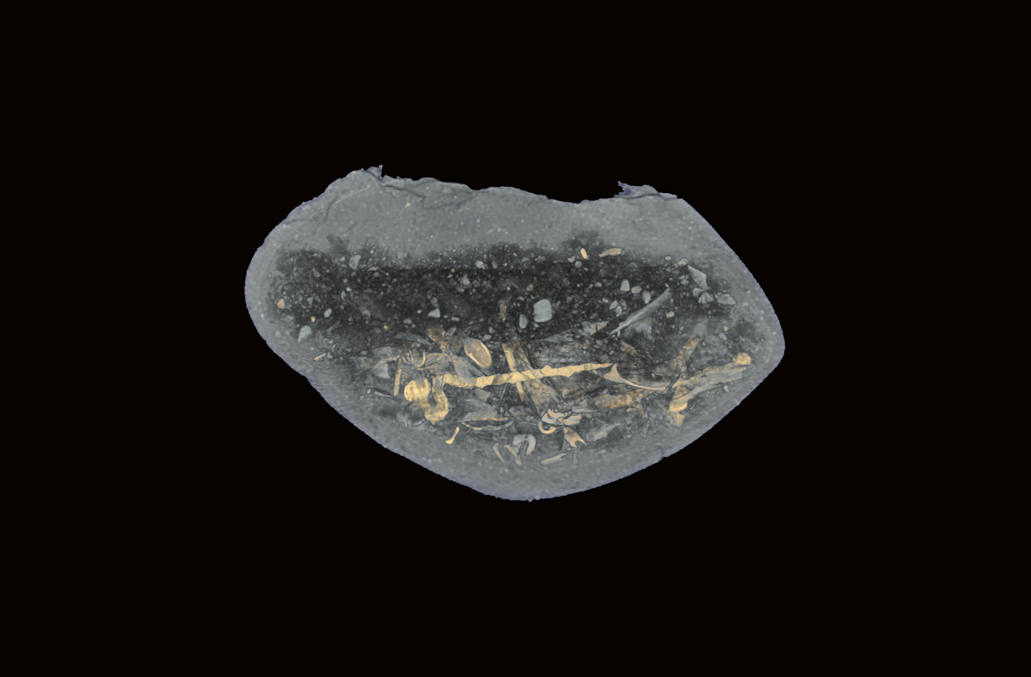 Inside the Urn: CT Scanning and Osteological Research
